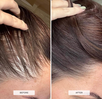 Hair Growth Biotin Gummies